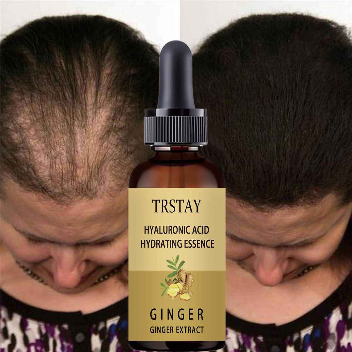 Hair Care Gisou - Siero per la crescita dei capelli