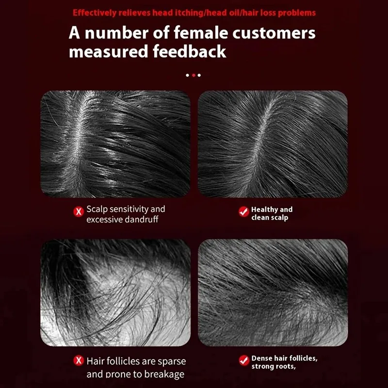 Pettine Massaggiante Elettrico - Hair Care For Hair Loss recensione e prezzo