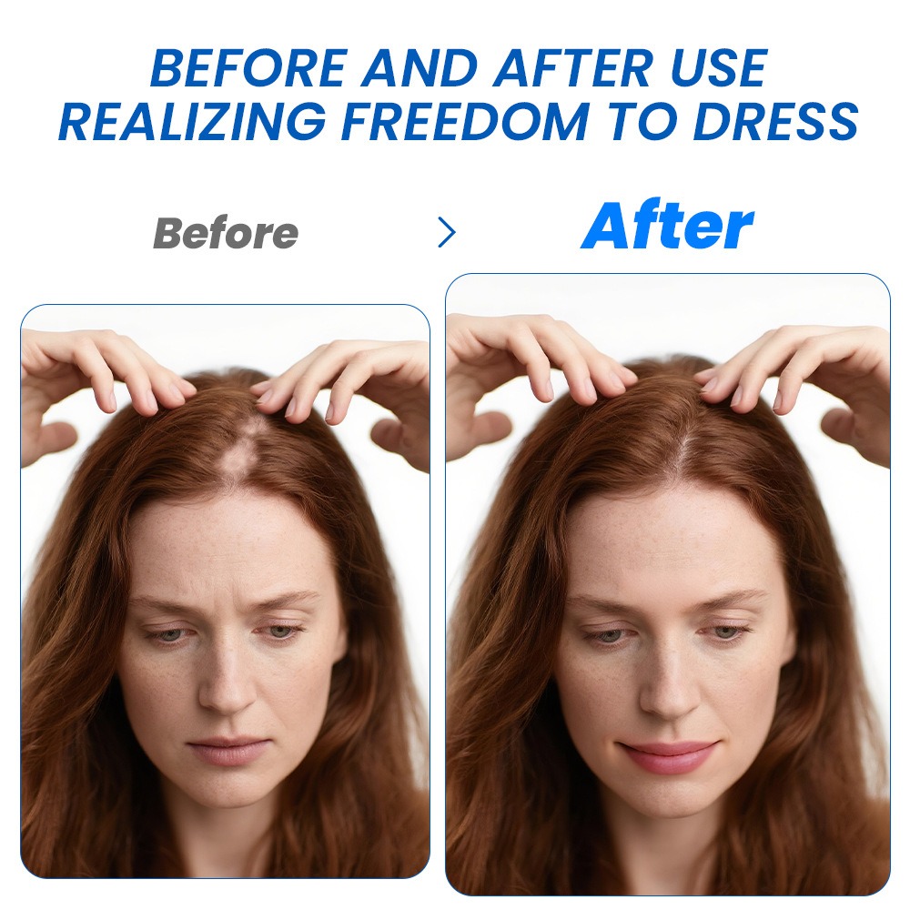 Alopecia Spray per la crescita - Hair Care For Hair Growth recensione e prezzo