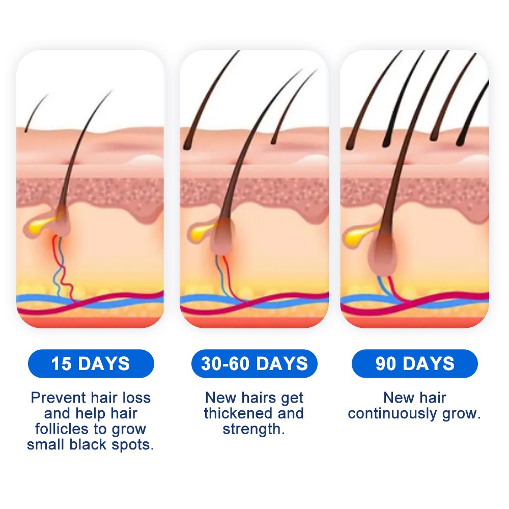 Alopecia Spray per la crescita - Hair Care For Hair Growth recensione e prezzo