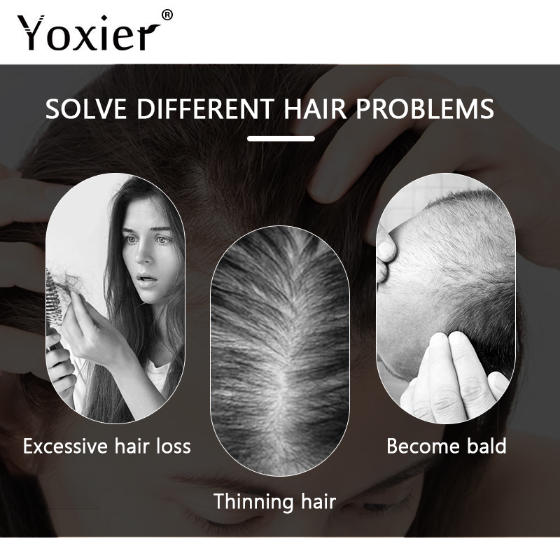 Siero per la crescita intensa  - Hair Care For Hair Loss recensione e prezzo