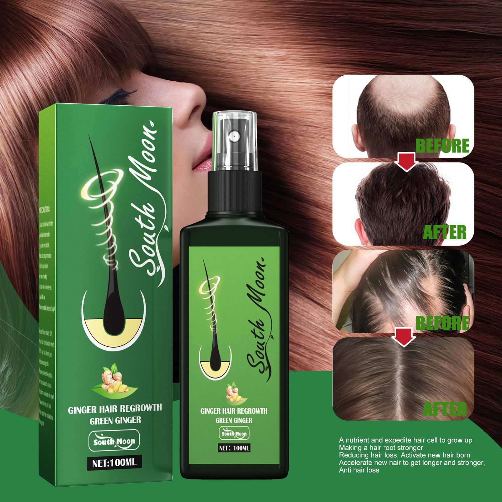 Spray per la Crescita dei Cape - Hair Care Natural Products recensione e prezzo