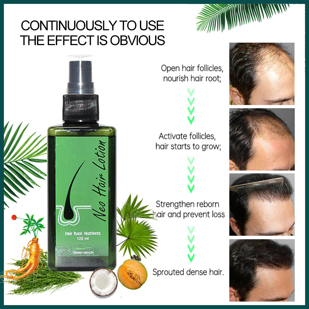 Lozione per capelli originale  - Hair Care Gisou recensione e prezzo