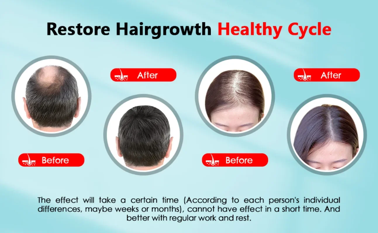Cuffia per la crescita dei cap - Hair Care Basic recensione e prezzo