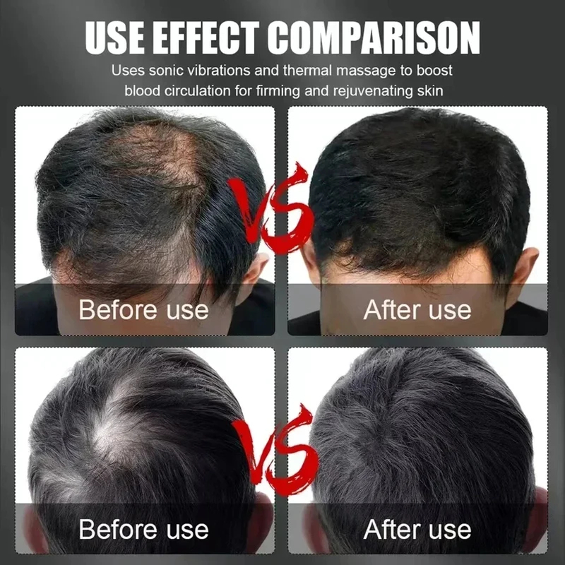Cappello Terapeutico per la Cr - Hair Care For Hair Loss recensione e prezzo